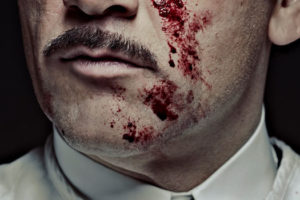 Série : The Knick de Steven Soderbergh avec Clive Owen